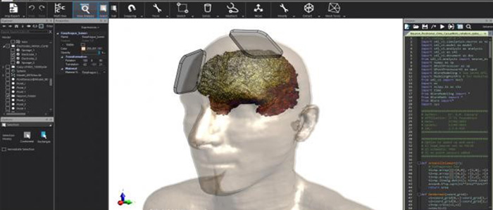 Sym4LifeV3_brain_700